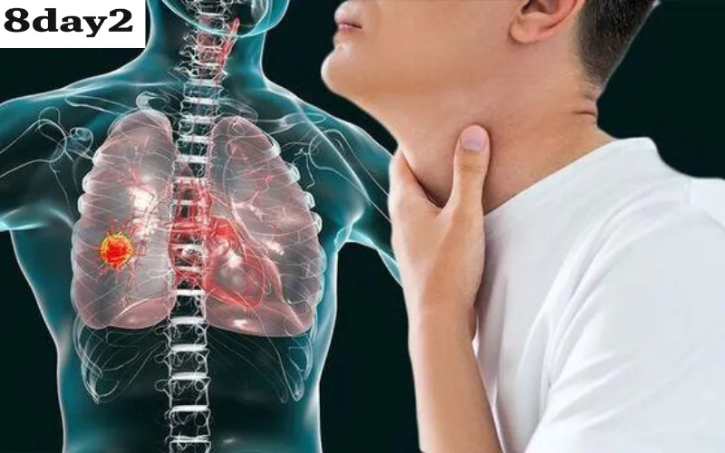 Những đối tượng nên tầm soát ung thư định kỳ