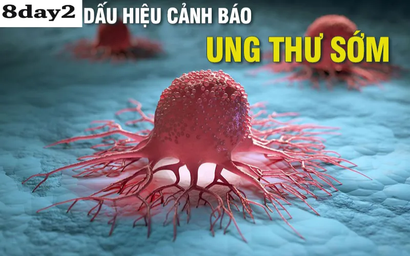 dấu hiệu ung thư sớm