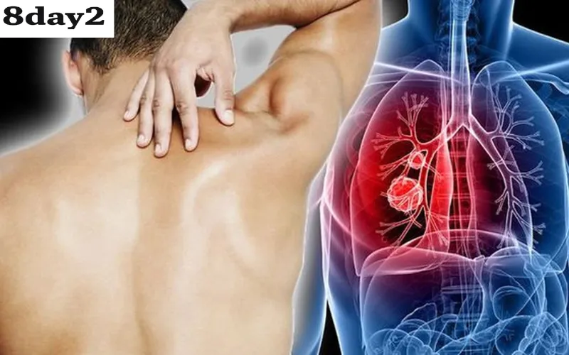 Những dấu hiệu ung thư sớm thường gặp
